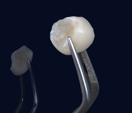 Slider image (2) Smile Zone Clinic